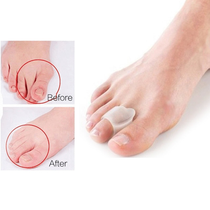 Silicone Toe Separator (Orthopaedic Tool)